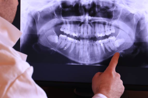 Best Emergency Dental Care for Trauma or Injury in Cascade, ID